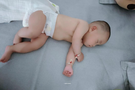 上杭六个月宝宝眼睛散光